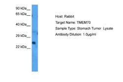 TMEM70 Rabbit anti-Human, Polyclonal, Novus Biologicals 0.1 mL | Buy Online | Novus Biologicals | Fisher Scientific